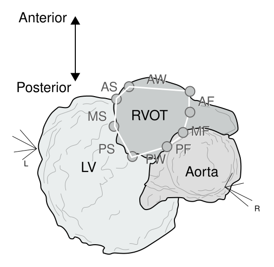 Yamashina rvot RFCA CARTO.svg