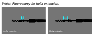 Helix-extension 5086-4076 Capsure fix novus.svg