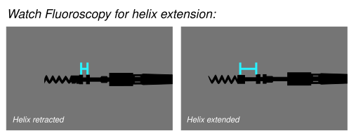 File:Helix-extension 5086-4076 Capsure fix novus.svg